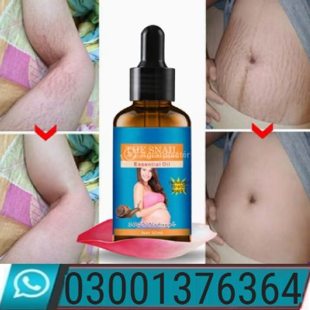 THE SNAIL Removes Essential Oil In Peshawar  ! 03001376364 ! New Shop