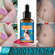 THE SNAIL Removes Essential Oil In Peshawar  ! 03001376364 ! New Shop